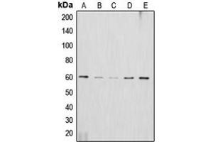 Western blot analysis of AKT2 expression in HeLa (A), HepG2 (B), NIH3T3 (C), mouse brain (D), rat brain (E) whole cell lysates.