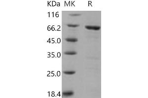 Western Blotting (WB) image for Mitogen-Activated Protein Kinase-Activated Protein Kinase 3 (MAPKAPK3) protein (GST tag) (ABIN7317094) (MAPKAP Kinase 3 Protein (GST tag))