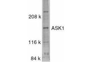 Western blot analysis of ASK1 in SW1353 whole cell lysate with ASK1 antibody at 0. (ASK1 antibody)