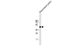 H1L recombinant protein probed with H1L (20CT26. (Tyr/ser Protein Phosphatase antibody)