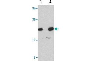 Western blot analysis of human liver tissue with NDUFB9 polyclonal antibody  at (Lane 1) 1 and (Lane 2) 2 ug/mL dilution. (NDUFB9 antibody  (C-Term))