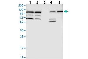 Western blot analysis of Lane 1: RT-4, Lane 2: U-251 MG, Lane 3: Human Plasma, Lane 4: Liver, Lane 5: Tonsil with RASGRF2 polyclonal antibody . (Ras Protein-Specific Guanine Nucleotide-Releasing Factor 2 (RASGRF2) antibody)