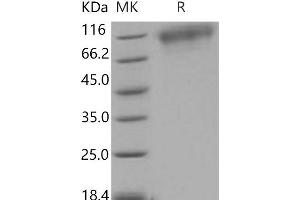 Western Blotting (WB) image for Neurotrophic tyrosine Kinase, Receptor, Type 3 (NTRK3) (Active) protein (His tag) (ABIN7320316) (NTRK3 Protein (His tag))