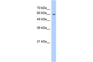 WB Suggested Anti-ATIC Antibody Titration:  1. (ATIC antibody  (N-Term))