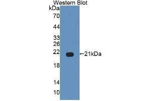Western blot analysis of the recombinant protein. (GAS6 antibody  (AA 503-664))