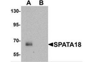 Western blot analysis of SPATA18 in rat lung tissue lysate with SPATA18 antibody at 1 ug/mL in (A) the absence and (B) the presence of blocking peptide (SPATA18 antibody  (N-Term))