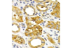 Immunohistochemistry of paraffin-embedded human kidney using CXCR3 Antibody. (CXCR3 antibody)