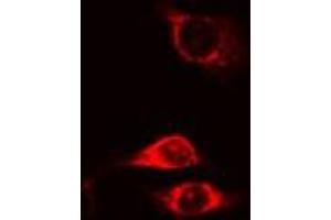ABIN6275640 staining Hela cells by IF/ICC. (MTERF antibody  (Internal Region))