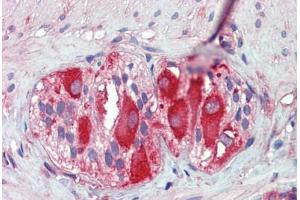 Small intestine, myenteric plexus, Human: Formalin-Fixed, Paraffin-Embedded (FFPE) (MCL-1 antibody)