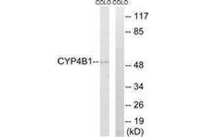 Western blot analysis of extracts from COLO cells, using Cytochrome P450 4B1 Antibody. (CYP4B1 antibody  (AA 141-190))
