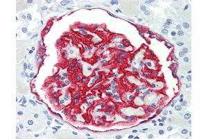 Human Kidney: Formalin-Fixed, Paraffin-Embedded (FFPE) (PODXL antibody)