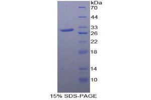 SDS-PAGE (SDS) image for Mitogen-Activated Protein Kinase-Activated Protein Kinase 2 (MAPKAPK2) (AA 139-367) protein (His tag) (ABIN2125909)