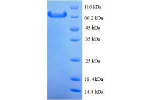 SDS-PAGE (SDS) image for Calpain 1 (CAPN1) (AA 1-713), (full length) protein (His tag) (ABIN5709189) (CAPN1 Protein (AA 1-713, full length) (His tag))