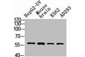 Western Blot analysis of HepG2-UV MOUSE-BRAIN AD293 K562 cells using VIM Polyclonal Antibody (Vimentin antibody  (C-Term))