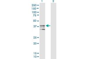 Western Blot analysis of ART4 expression in transfected 293T cell line by ART4 MaxPab polyclonal antibody. (ART4 antibody  (AA 1-314))