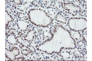 Image no. 1 for anti-Negative Regulator of Ubiquitin-Like Proteins 1 (NUB1) (AA 1-326) antibody (ABIN1490743)
