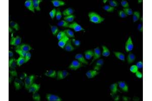 Immunofluorescence staining of Hela cells with ABIN7167381 at 1:133, counter-stained with DAPI. (RAB7B antibody  (AA 100-199))