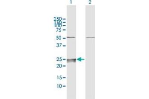 Western Blot analysis of CMPK expression in transfected 293T cell line by CMPK MaxPab polyclonal antibody. (Cytidine Monophosphate (UMP-CMP) Kinase 1, Cytosolic (CMPK1) (AA 1-228) antibody)