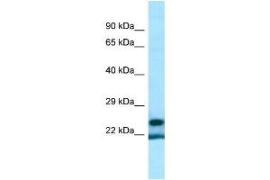 WB Suggested Anti-YRDC Antibody Titration: 1.