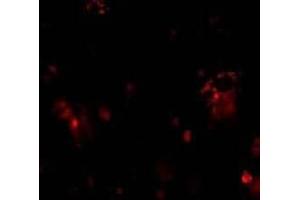 Immunofluorescent staining of DcR1 in rat liver tissue with DcR1 antibody at 10μg/ml. (DcR1 antibody)