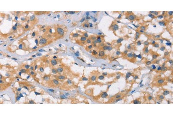 Desmocollin 2 antibody