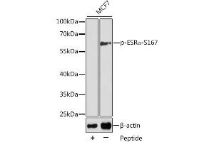 Western blot analysis of extracts from MCF7 cells using Phospho-ESRα-S167 antibody (ABIN3020207, ABIN3020208, ABIN3020209 and ABIN7101869). (Estrogen Receptor alpha antibody  (pSer167))