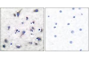 Immunohistochemistry analysis of paraffin-embedded human brain, using DARPP-32 (Phospho-Thr34) Antibody. (DARPP32 antibody  (pThr34))