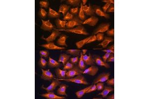 Immunofluorescence analysis of U2OS cells using RPS28 Rabbit pAb (ABIN7270024) at dilution of 1:100. (RPS28 antibody)