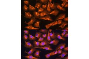 Immunofluorescence analysis of U2OS cells using RPS28 Rabbit pAb (ABIN7270024) at dilution of 1:100. (RPS28 antibody)