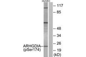 Western blot analysis of extracts from HuvEc cells treated with EGF 200ng/ml 30', using ARHGDIA (Phospho-Ser174) Antibody. (ARHGDIA antibody  (pSer174))