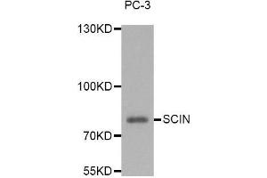 Western blot analysis of extracts of PC-3 cell line, using SCIN antibody. (Scinderin antibody)