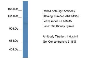 Western Blotting (WB) image for anti-Ligase III, DNA, ATP-Dependent (LIG3) (Middle Region) antibody (ABIN2785978) (LIG3 antibody  (Middle Region))