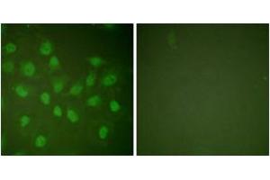 Immunofluorescence analysis of HeLa cells, using POLR2A (Ab-1619) Antibody. (POLR2A/RPB1 antibody  (AA 1585-1634))