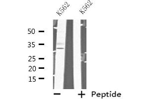 Western blot analysis of extracts from K562 cells, using MAD2L1BP antibody. (MAD2L1BP antibody  (N-Term))