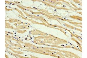 IHC image of ABIN7160149 diluted at 1:400 and staining in paraffin-embedded human heart tissue performed on a Leica BondTM system. (ABHD6 antibody  (AA 105-211))