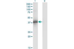 Western Blot analysis of CGRRF1 expression in transfected 293T cell line by CGRRF1 monoclonal antibody (M04), clone 1A4. (CGR19 antibody  (AA 1-332))