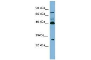 Image no. 1 for anti-Transglutaminase 3 (E Polypeptide, Protein-Glutamine-gamma-Glutamyltransferase) (TGM3) (N-Term) antibody (ABIN6741686) (TGM3 antibody  (N-Term))