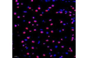 Immunofluorescence of paraffin embedded mouse brain using PRPF4 (ABIN7075312) at dilution of 1: 500 (400x lens) (PRPF4 antibody)