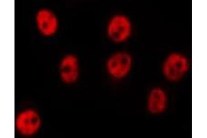 ABIN6275658 staining HepG2 by IF/ICC. (USP44 antibody  (Internal Region))