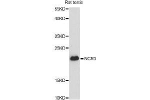 Western blot analysis of extracts of rat testis, using CALM3 antibody (ABIN6294040) at 1:3000 dilution. (Calmodulin 3 antibody)