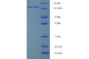 SDS-PAGE (SDS) image for Interferon Regulatory Factor 5 (IRF5) (AA 1-497), (full length) protein (His-SUMO Tag) (ABIN5709765) (IRF5 Protein (AA 1-497, full length) (His-SUMO Tag))