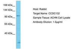 Image no. 1 for anti-Coiled-Coil Domain Containing 132 (CCDC132) (N-Term) antibody (ABIN6750636) (Syndetin/VPS50 antibody  (N-Term))