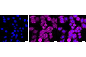 anti-Desmoplakin (DSP) antibody