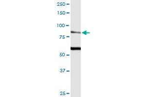 TRPV5 antibody  (AA 1-100)