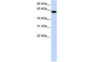 WB Suggested Anti-CCDC11 Antibody Titration: 0. (CCDC11 antibody  (N-Term))