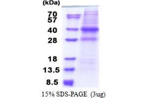 SDS-PAGE (SDS) image for Capping Protein (Actin Filament) Muscle Z-Line, alpha 2 (CAPZA2) (AA 1-286) protein (His tag) (ABIN5853277) (CAPZA2 Protein (AA 1-286) (His tag))