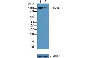Knockout Varification: Lane 1: Wild-type A549 cell lysate, Lane 2: TLR5 knockout A549 cell lysate, Predicted MW: 97kd Observed MW: 105kd Primary Ab: 3 μg/mL Rabbit Anti-Human TLR5 Antibody Second Ab: 0. (TLR5 antibody  (AA 46-205))
