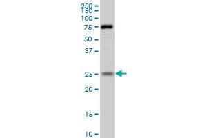 RAB33B antibody  (AA 117-206)