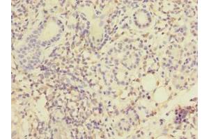 Immunohistochemistry of paraffin-embedded human pancreatic tissue using ABIN7159469 at dilution of 1:100 (MPPED1 antibody  (AA 1-326))