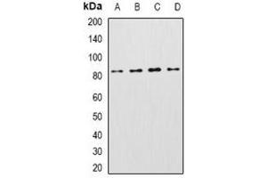 Western blot analysis of KCNN3 expression in Raji (A), mouse heart (B), mouse livere (C), rat brain (D) whole cell lysates. (KCNN3 antibody)